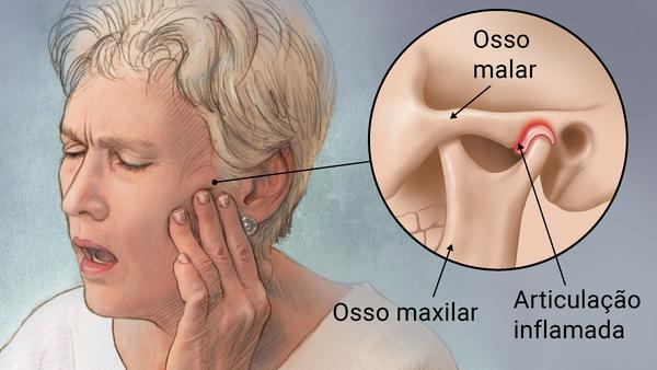 Mandíbula e Articulação Temporomandibular