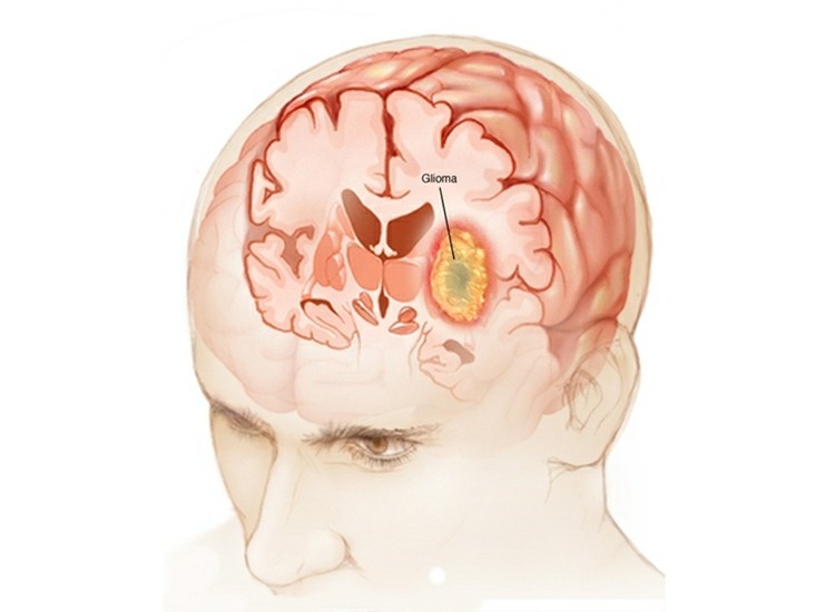 Painel Sistema Nervoso Central