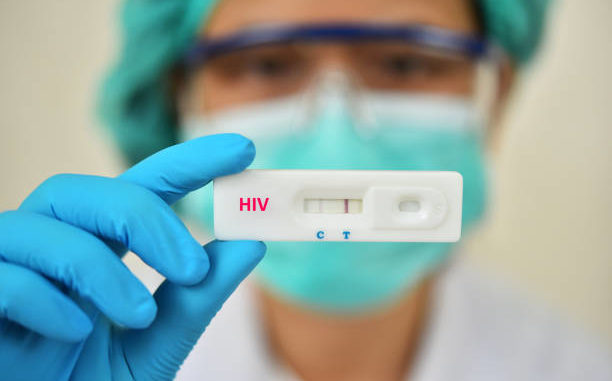 Lab technician holding HIV rapid device test, the result showed positive