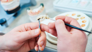 Próteses dentárias podem conter prata (Ag) ao longo do polímero para evitar infecções bacterianas. [Imagem: Reprodução/Senac]