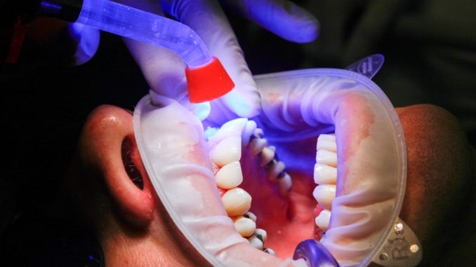 laser odontologia