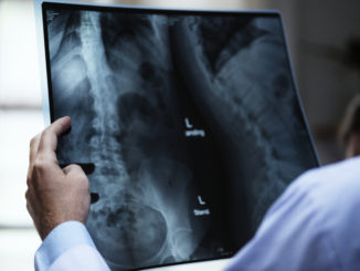 A osteoporose é uma doença que atinge milhões de brasileiros - [Reprodução/Freepik]